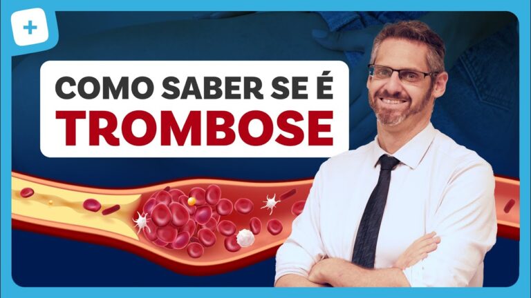 TROMBOSE: o que é, sintomas, tratamentos e causas.